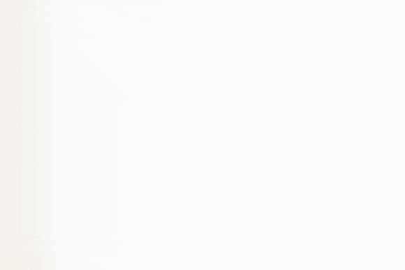 성동구보톡스, 부작용을 걱정하시는 분들께 관련 이미지 10