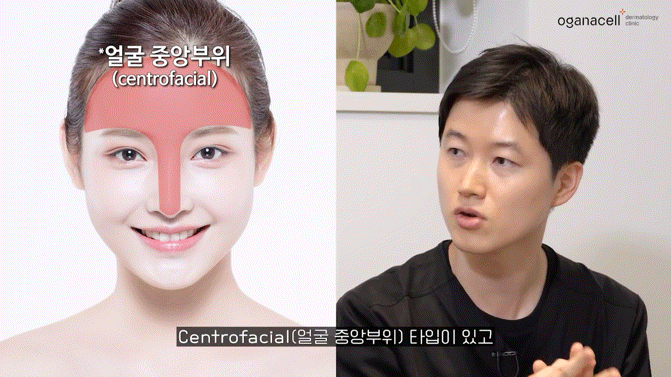 기미치료피부과 신중하게 선택해요 관련 이미지 18