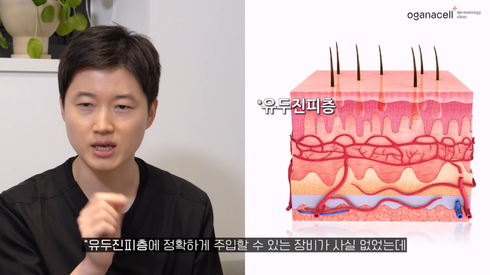 튼살큐어젯 고민을 해결하는 관련 이미지 25