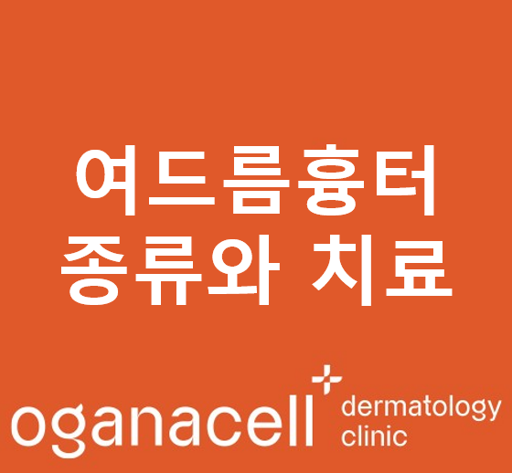 여드름흉터 포기하지 말고 치료할수 있습니다 관련 이미지 1