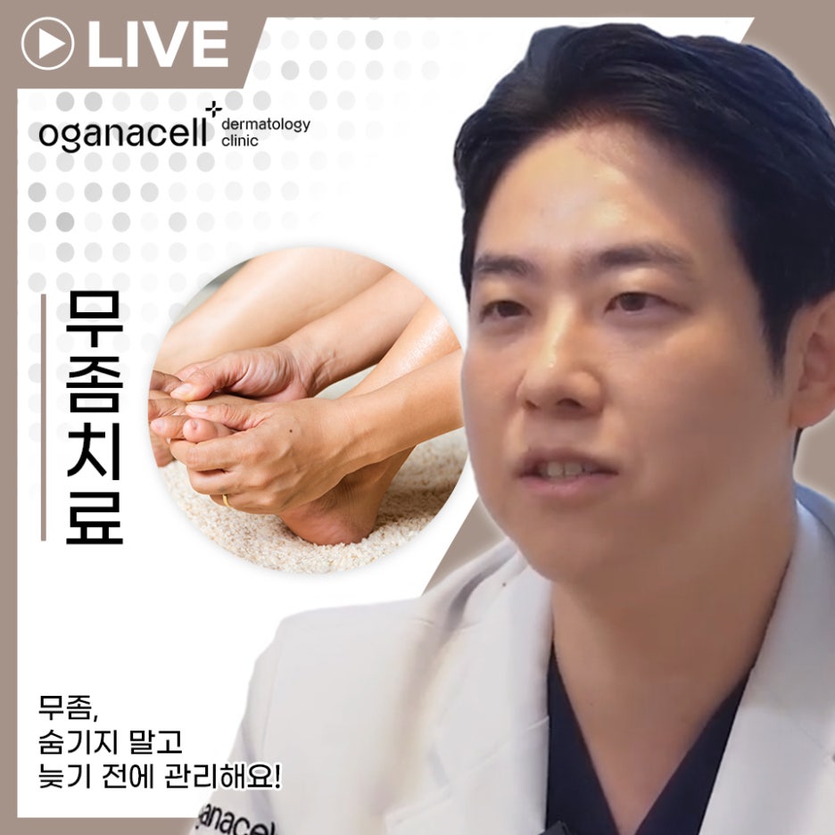 동대문무좀치료 개선을 기대한다면 관련 이미지 1