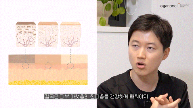 동대문레이저토닝 맑은 피부를 위해 관련 이미지 10