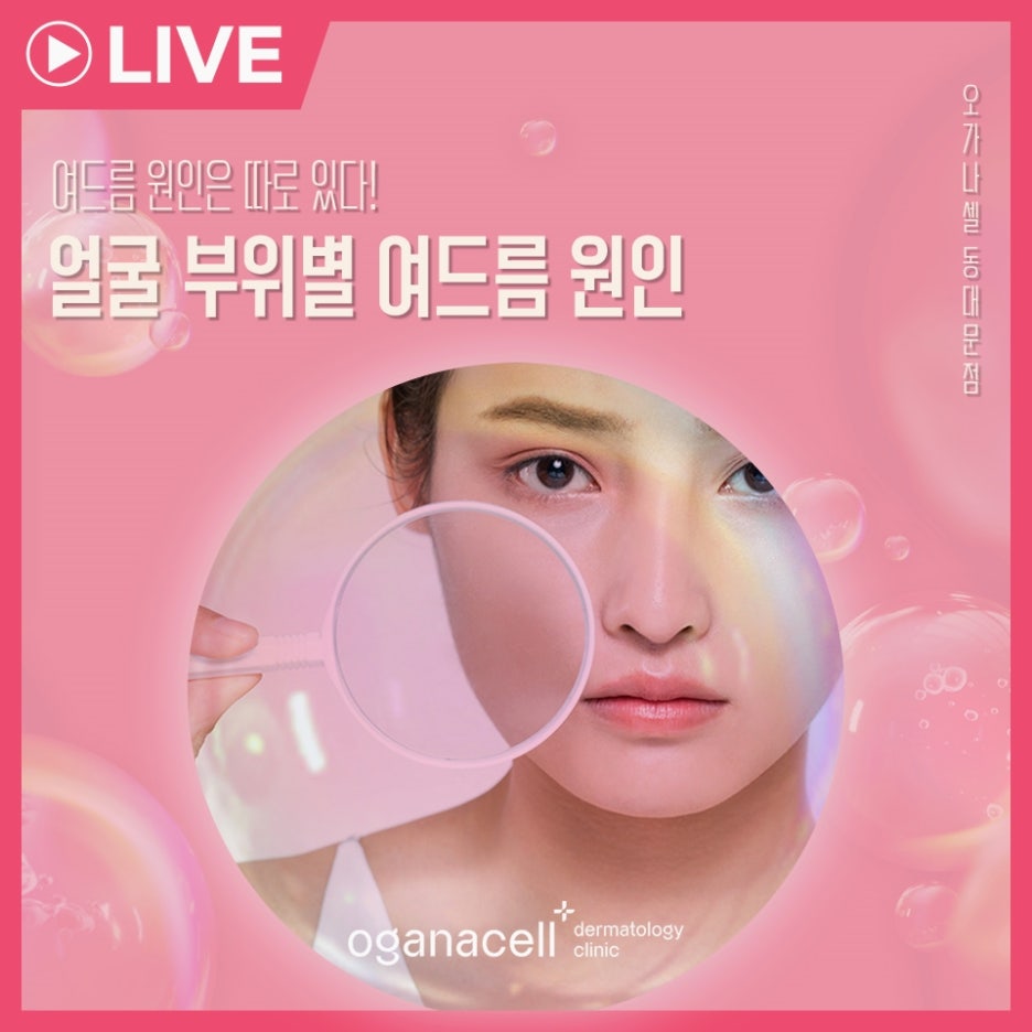 얼굴 부위별 여드름 원인 살펴볼까요 관련 이미지 1