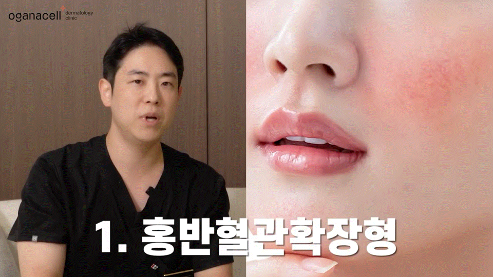 동대문홍조치료 유형별 원인을 파악해요 관련 이미지 5