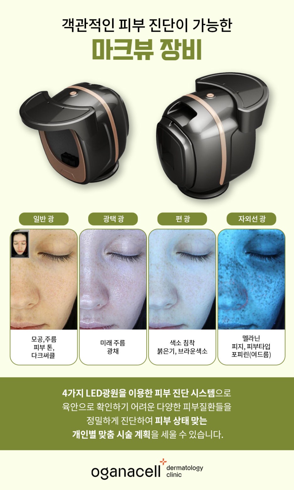 동대문역피부과 튼살 피부 고민 해결은 관련 이미지 27