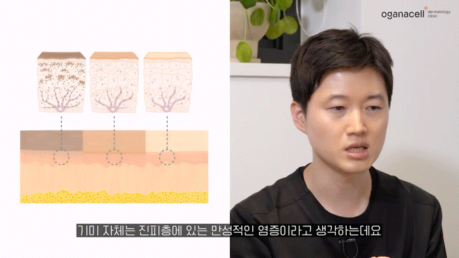 동대문레이저토닝 맑은 피부를 위해 관련 이미지 9