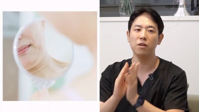 이중턱지방분해주사 매끄러운 라인으로 관련 이미지 10