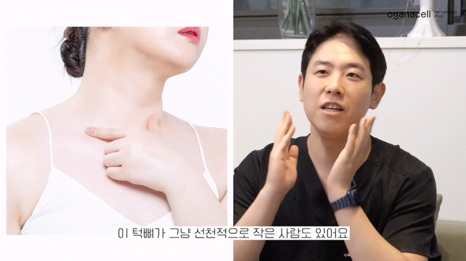 이중턱지방분해주사 매끄러운 라인으로 관련 이미지 8
