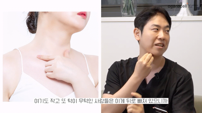 이중턱지방분해주사 매끄러운 라인으로 관련 이미지 9