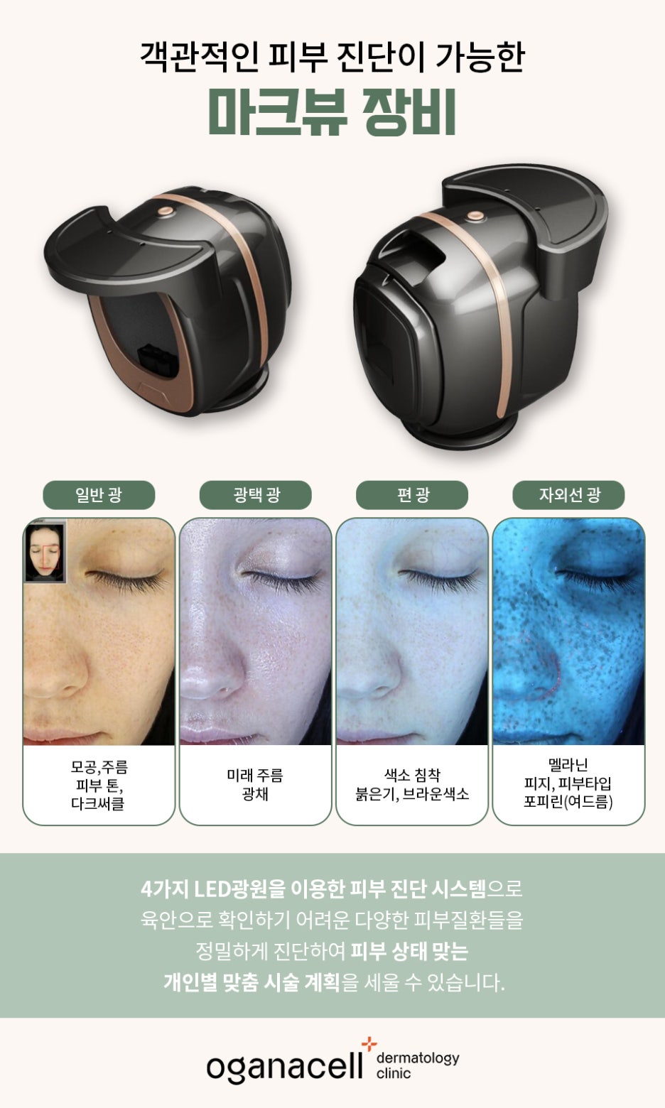 제기동역피부과 초기에 잡아요 관련 이미지 27