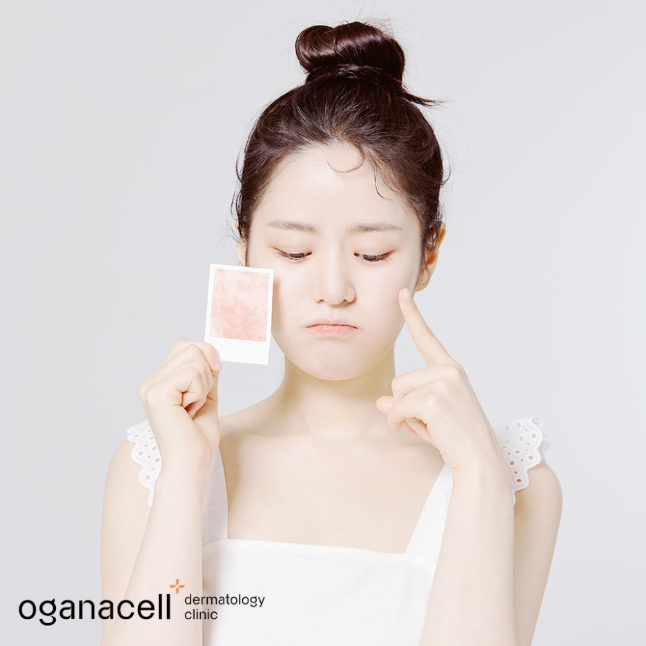 청량리여드름 피부 환경이 중요해요 관련 이미지 29