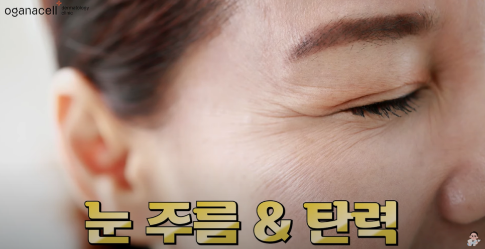 눈가 주름 완벽 정복 관련 이미지 1