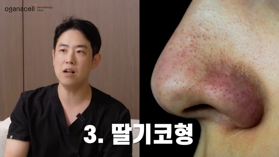 동대문홍조치료 유형별 원인을 파악해요 관련 이미지 7