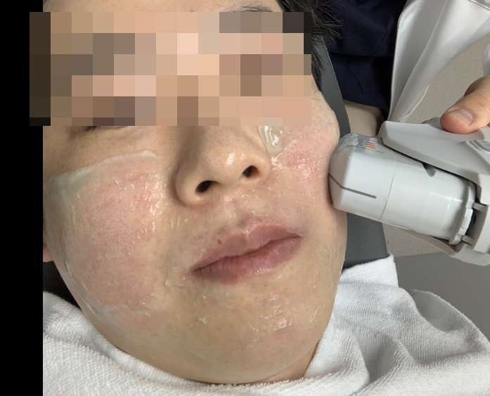 [동대문피부과] 모공, 좋아질수 있습니다! 관련 이미지 4