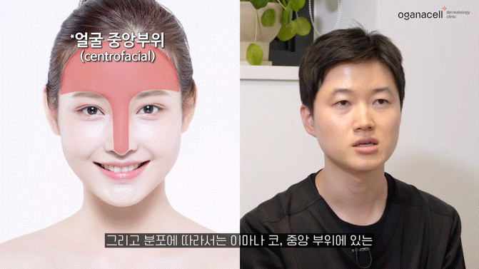 기미치료피부과 신중하게 선택해요 관련 이미지 17