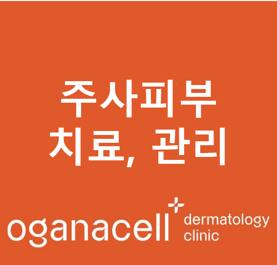 주사피부염 (민감성피부, 안면홍조)치료, 관리 (2) 관련 이미지 1