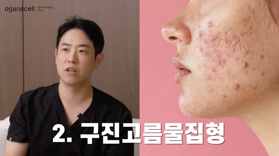 동대문홍조치료 유형별 원인을 파악해요 관련 이미지 6