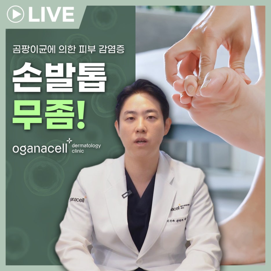 제기동역피부과 초기에 잡아요 관련 이미지 1