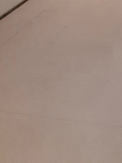 동대문무좀치료 개선을 기대한다면 관련 이미지 38