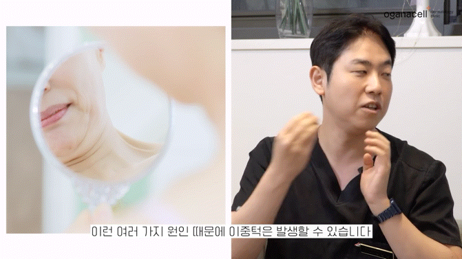 이중턱지방분해주사 매끄러운 라인으로 관련 이미지 12