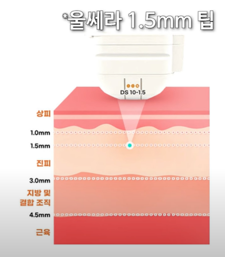 눈가 주름 완벽 정복 관련 이미지 10