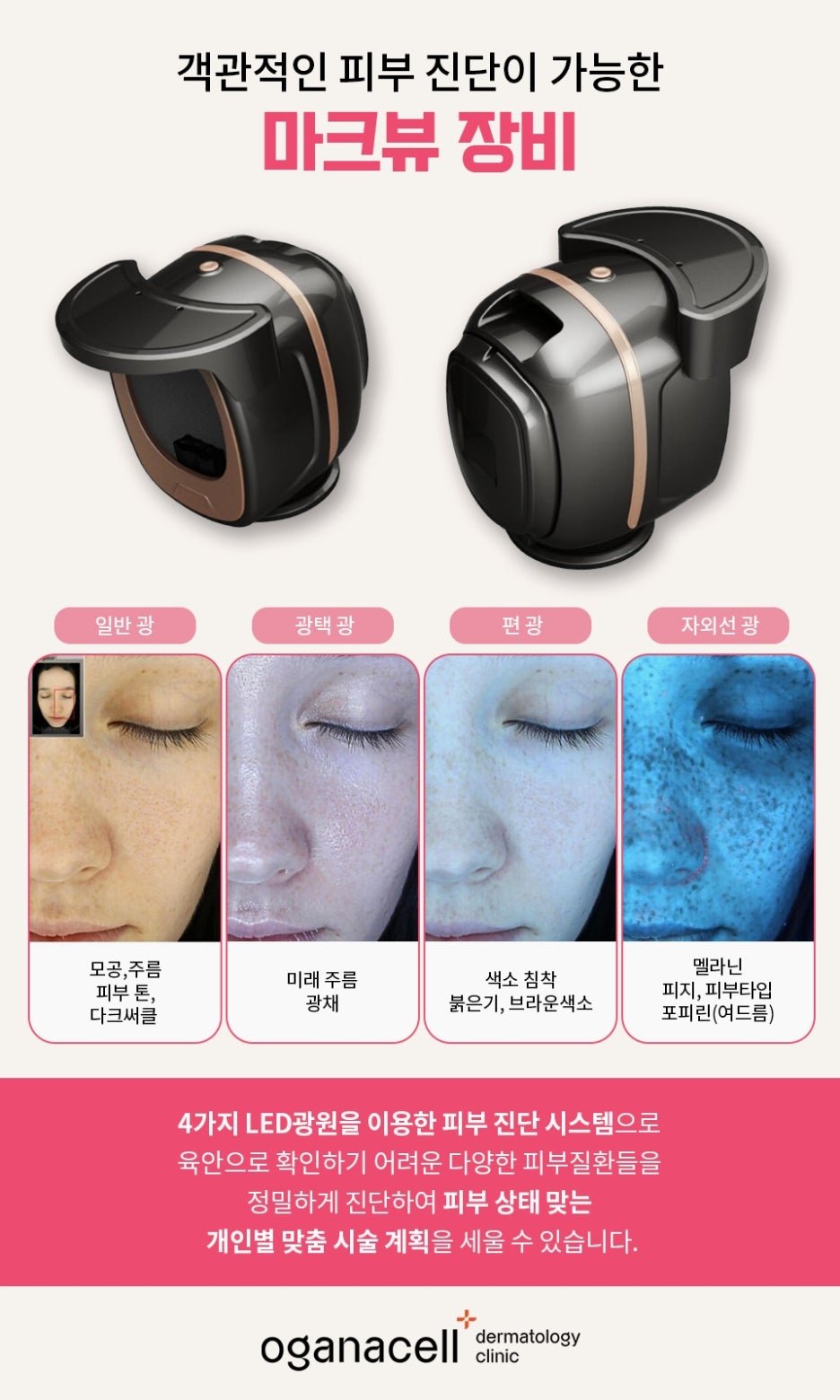 얼굴 부위별 여드름 원인 살펴볼까요 관련 이미지 7