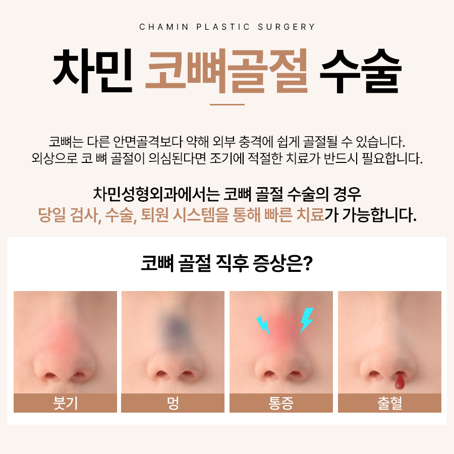 코뼈 골절 병원, 수술, 부러짐 증상이 느껴질 때 당일 진료! 관련 이미지 1