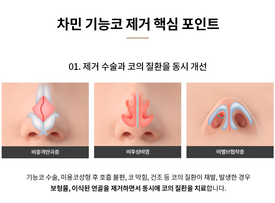 코수술 후 코막힘, 이물감, 불안할 때 [차민 기능코제거] 관련 이미지 8