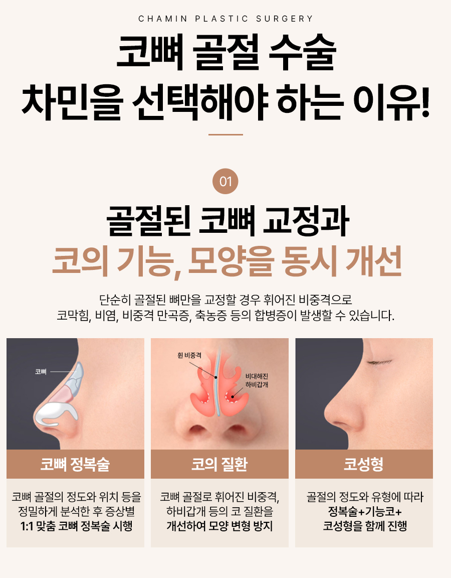 코뼈 골절 병원, 수술, 부러짐 증상이 느껴질 때 당일 진료! 관련 이미지 11