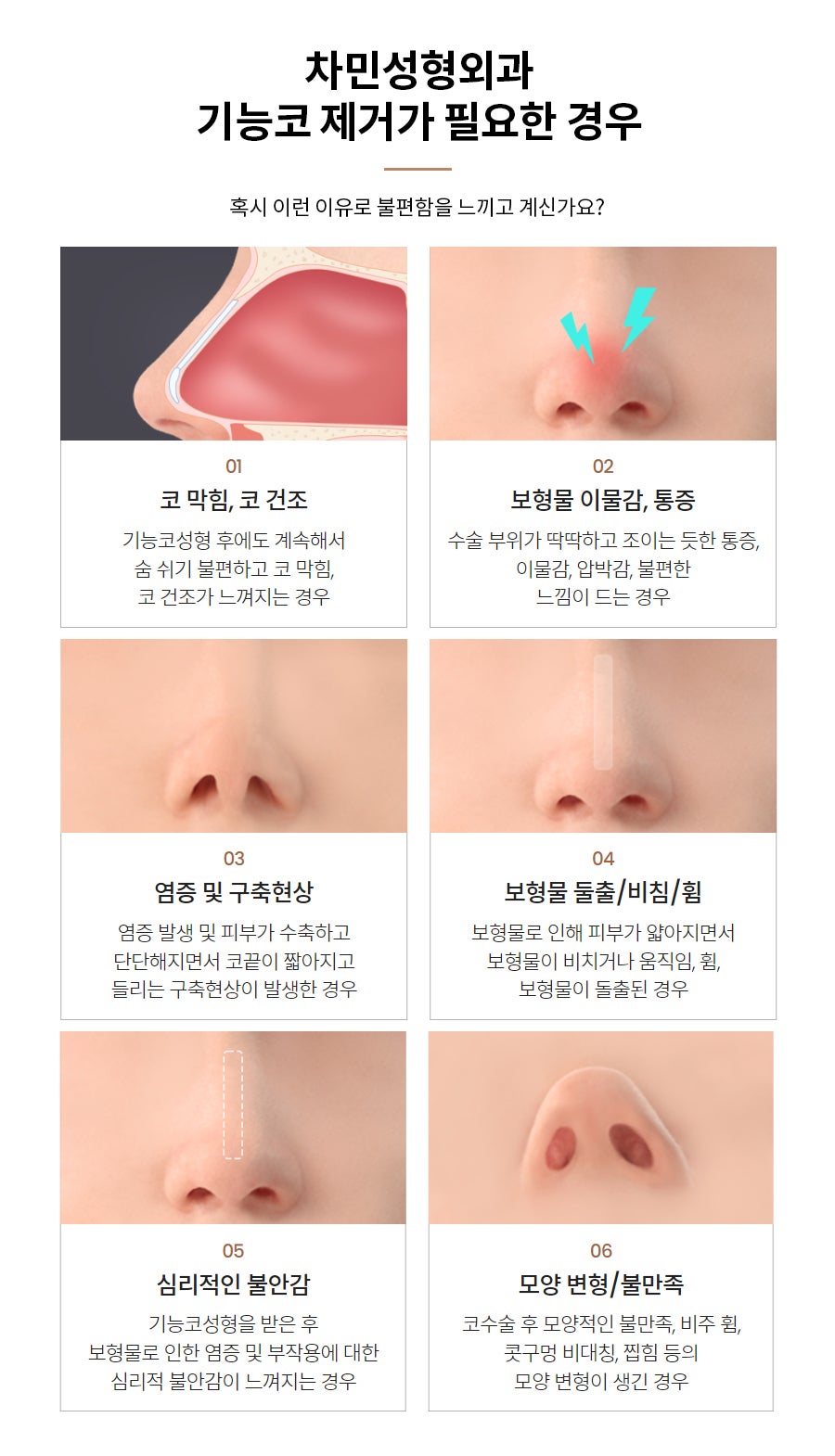 코수술 후 코막힘, 이물감, 불안할 때 [차민 기능코제거] 관련 이미지 4