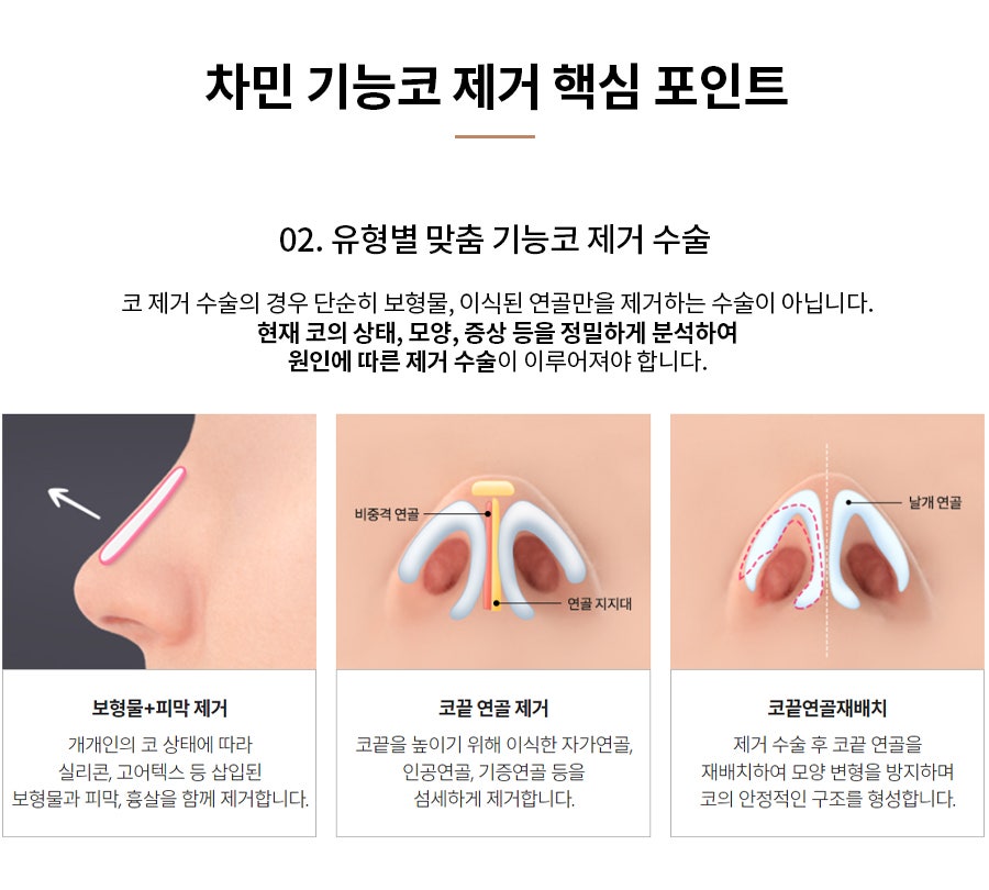 코수술 후 코막힘, 이물감, 불안할 때 [차민 기능코제거] 관련 이미지 10