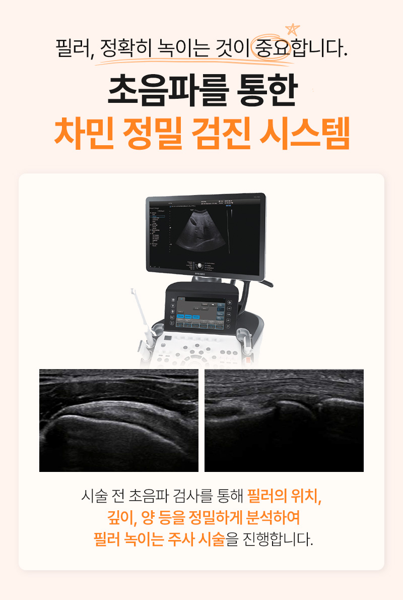 이마필러 녹이기, 필러 녹이는 주사 비용, 병원은? 차민성형외과 관련 이미지 15