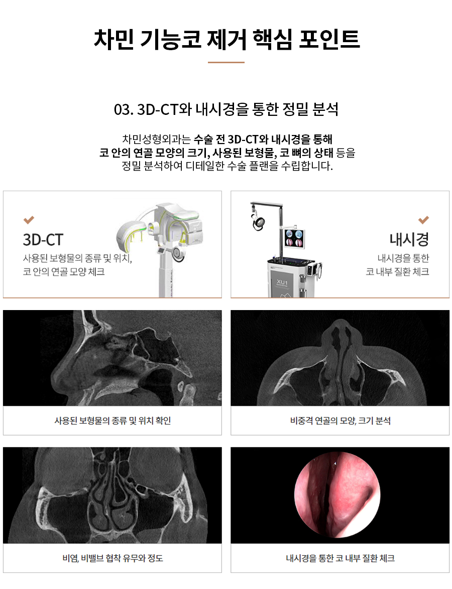코수술 후 코막힘, 이물감, 불안할 때 [차민 기능코제거] 관련 이미지 11