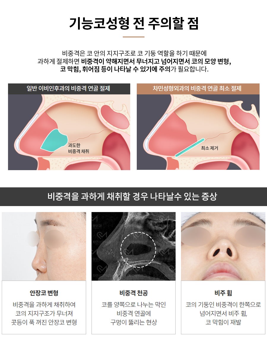 코수술 후 코막힘, 이물감, 불안할 때 [차민 기능코제거] 관련 이미지 9