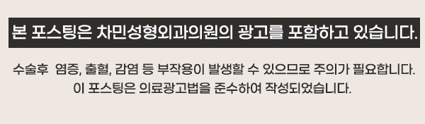 코수술 후 구축으로 짧고 들린 코 (휜코, 코끝 길이 연장, 자가늑연골) 관련 이미지 19