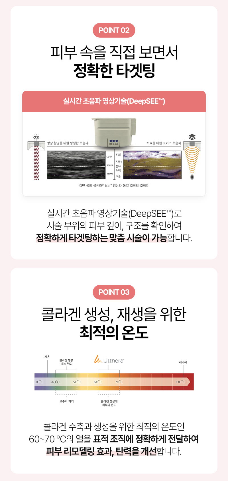 울쎄라 300샷 가격, 통증, 잘하는곳, 레이저리프팅 관련 이미지 7