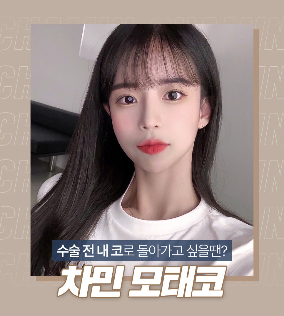 코 보형물 제거 : 차민성형외과에서 모태코로 돌아가기 관련 이미지 8