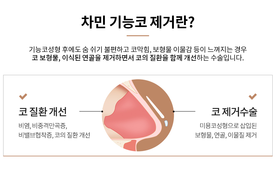 코수술 후 코막힘, 이물감, 불안할 때 [차민 기능코제거] 관련 이미지 2