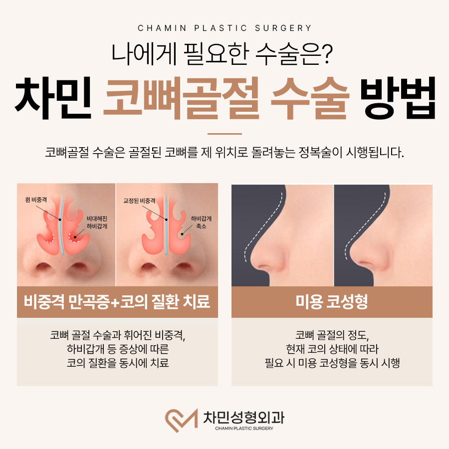 코뼈 골절 병원, 수술, 부러짐 증상이 느껴질 때 당일 진료! 관련 이미지 9