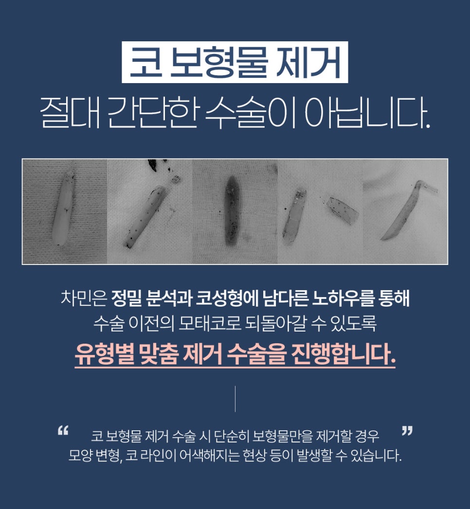 코 보형물 제거 : 차민성형외과에서 모태코로 돌아가기 관련 이미지 3