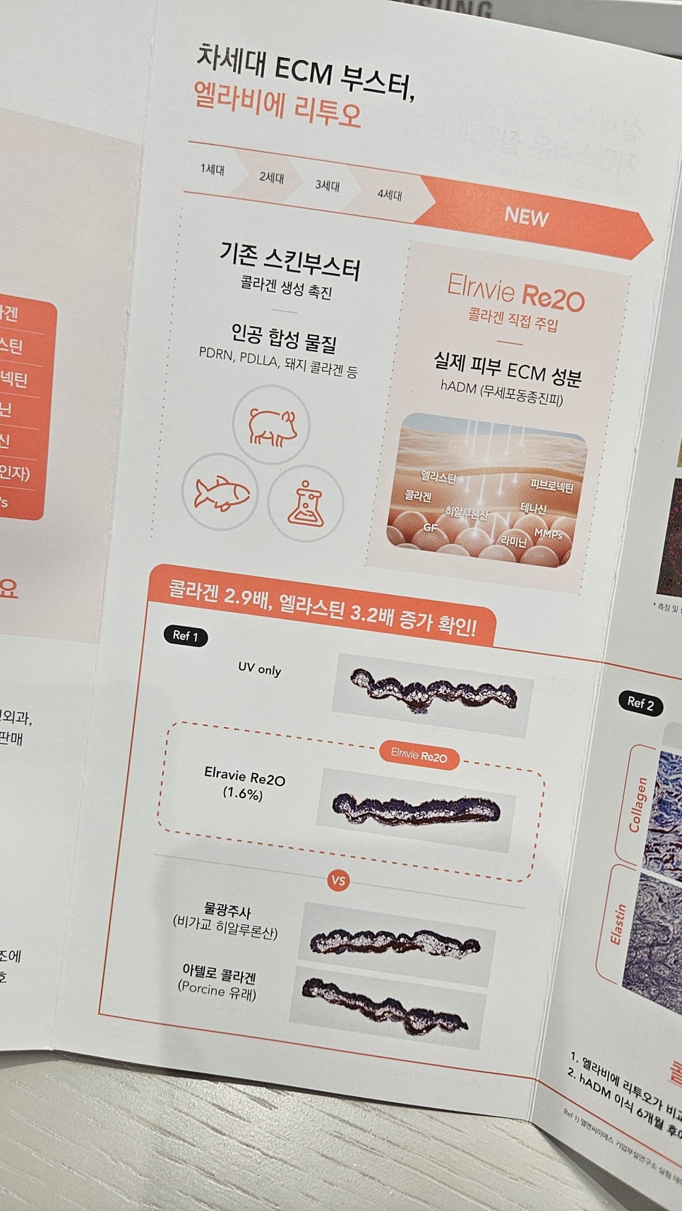 Elravie RE20: How Is It Different from Existing Skin Booster Treatments? Explanation from a Yeongdeungpo Dermatology Specialist image 3