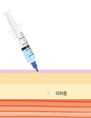 Yeongdeungpo Dermatology: Looking Into JUVELOOK Treatment for Peanut-Shaped Face Volume Improvement, Pores, and Scars image 5