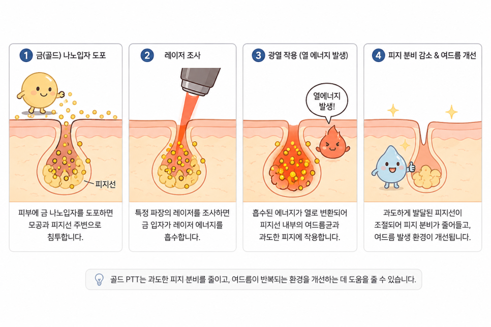 Yeongdeungpo Dermatology: Gold PTT Benefits—Acne Care with Less Discomfort image 2