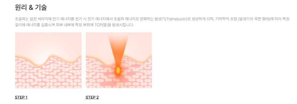 슈링크 화상 부작용, 정말 생길 수 있을까? 영등포 피부과 전문의 관련 이미지 1
