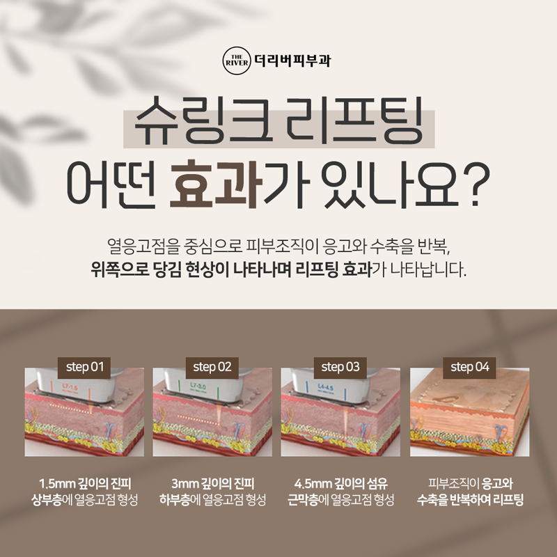 Dangsan Shurink, Should I Try It Too? image 3