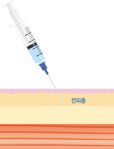 Yeongdeungpo Dermatology: Looking Into JUVELOOK Treatment for Peanut-Shaped Face Volume Improvement, Pores, and Scars image 6