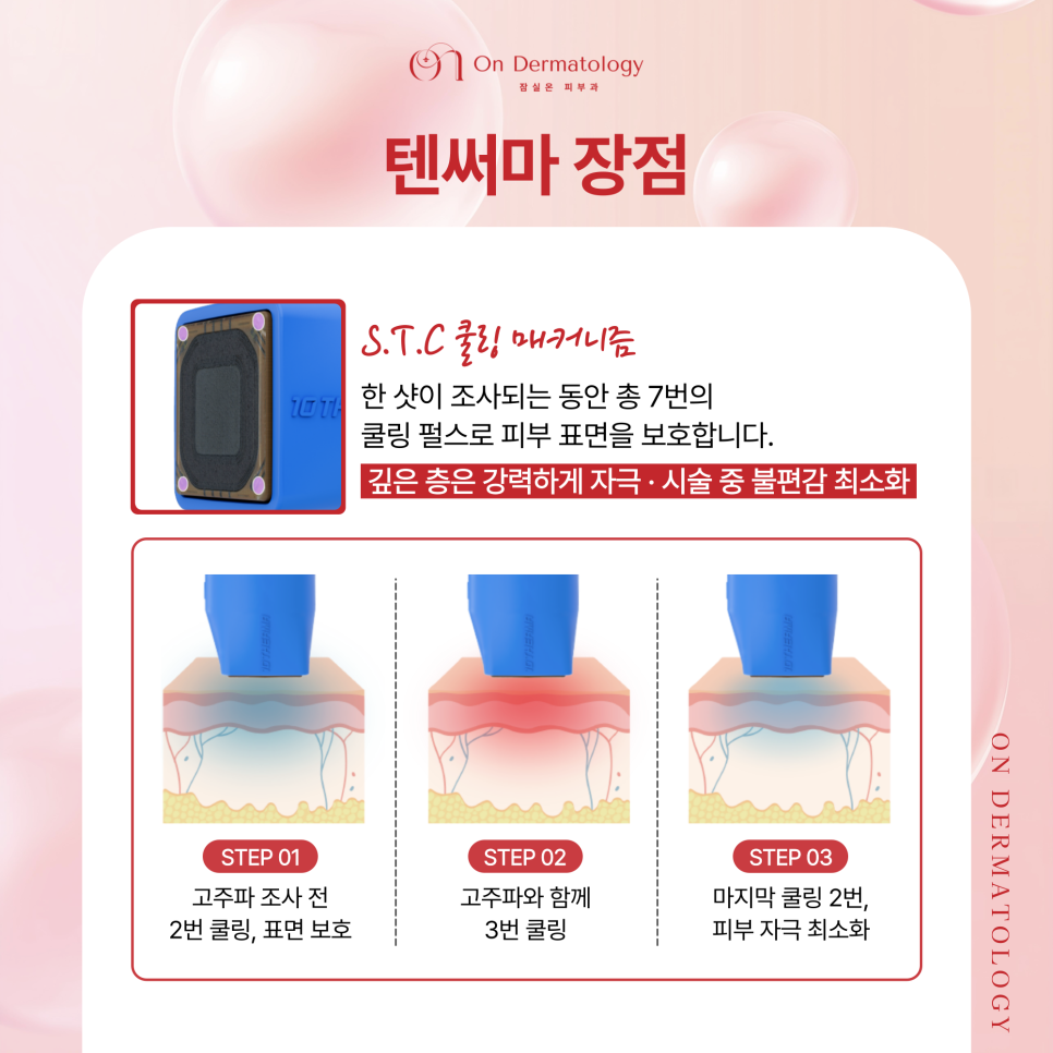 잠실역 피부과 써마지와 텐써마 2가지 고주파 리프팅, 탄력 및 콜라겐 관리 관련 이미지 6