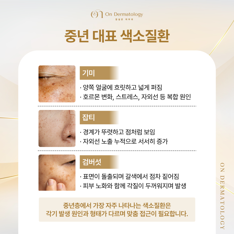 Jamsil Dermatology Clinic: Laser Pigment Treatment for Middle-Aged Concerns Such as Melasma and Age Spots image 2