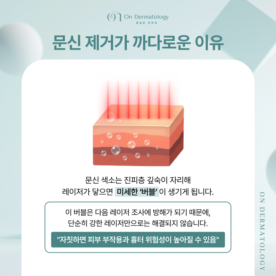 잠실 문신제거 피부과 피코레이저 문신 치료 후 관리는 이렇게 관련 이미지 2