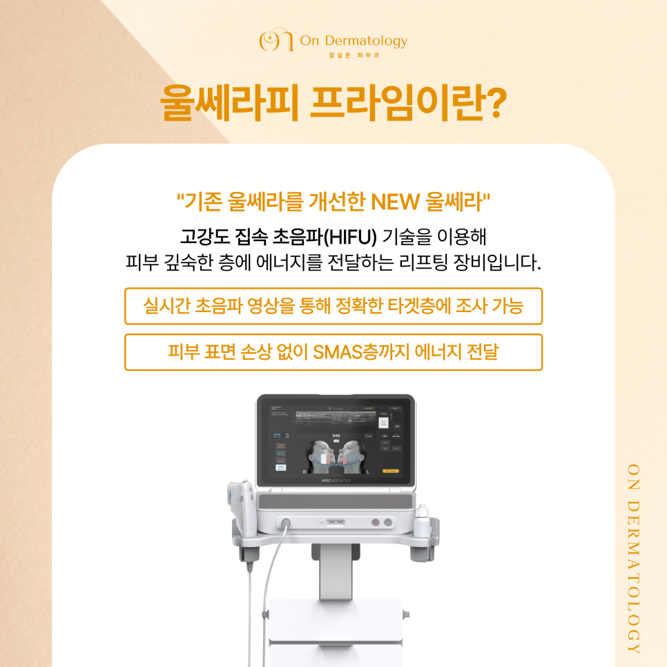 잠실역 피부과 울쎄라피 프라임, 기존 울쎄라와 뭐가 다를까? 써마지FLX와의 차이? 관련 이미지 2